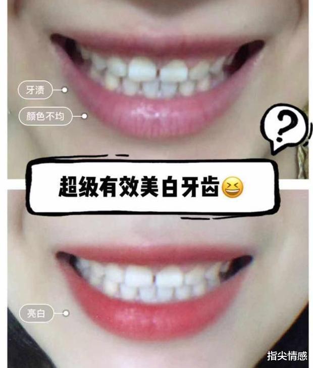 时尚好物官 李佳琦推荐的牙膏“火了”，景甜：黄牙消失了，网友：效果贼好