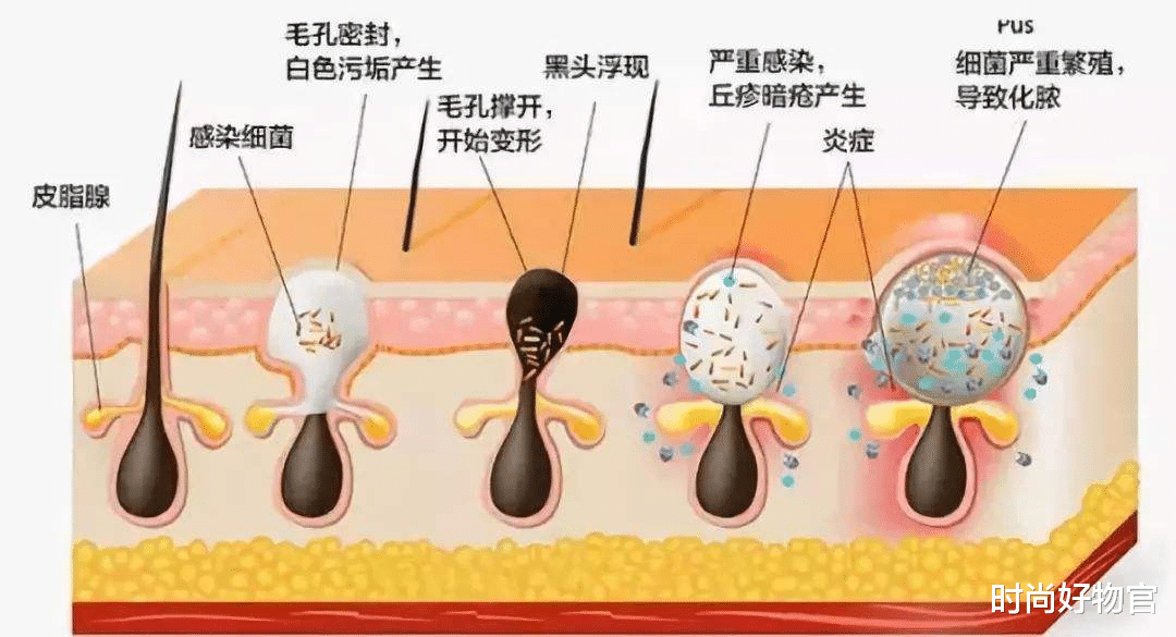 戚薇|一个被玻尿酸毁了的女星，如今38岁面目全非，年轻时五官精致耐看