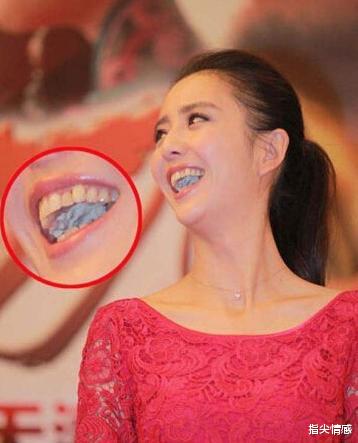 时尚好物官 李佳琦推荐的牙膏“火了”，景甜：黄牙消失了，网友：效果贼好