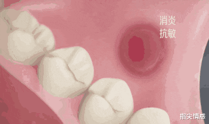 时尚好物官 李佳琦推荐的牙膏“火了”，景甜：黄牙消失了，网友：效果贼好