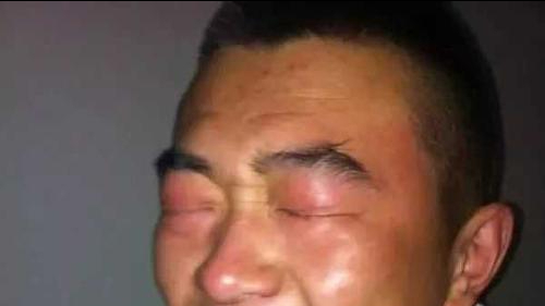 为什么电焊对人有那么大的伤害?