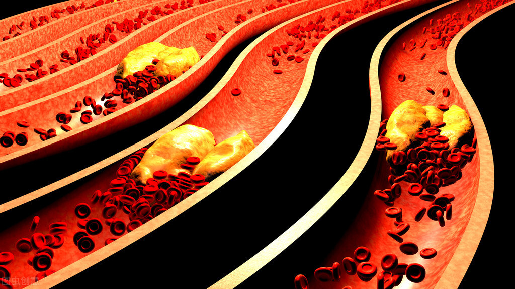 高血压|比肥肉和烟酒更可怕的“脑梗杀手”，原来是它，我们几乎天天在吃