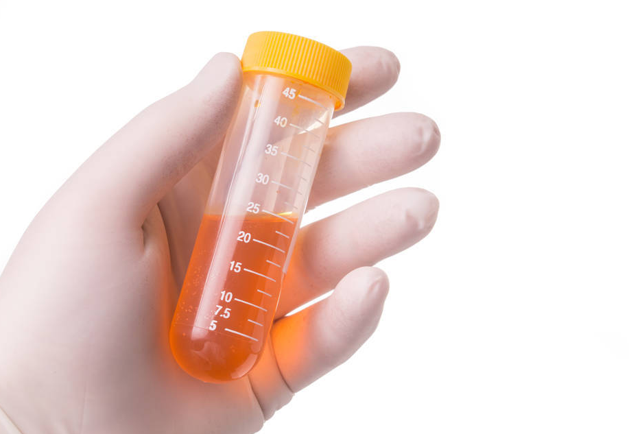 蔬菜|晨起上厕所时，若有这4种反应，你的尿酸可能已经“结晶”，别大意了！