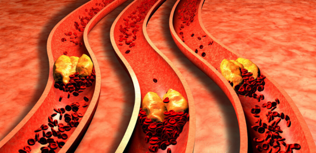 胆固醇|胆固醇“大户”不是肥肉,第一名许多家庭天天吃,很多人还不知道