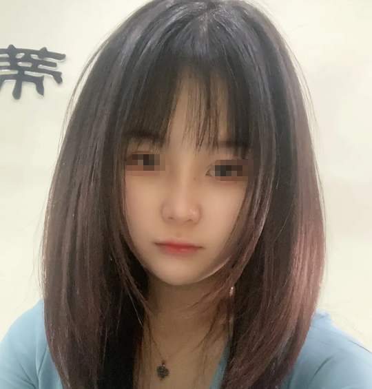 “不知道哪根筋搭错了，非要去整容”以前真好看