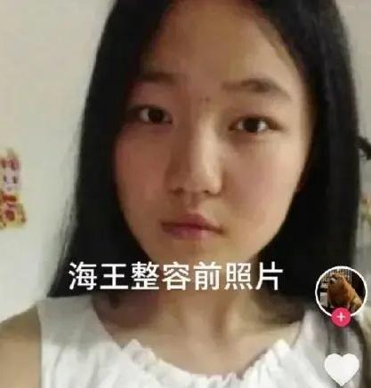 郭麒麟|项思醒整容前照片曝光，富二代男友退婚后，被曝彩礼已退回