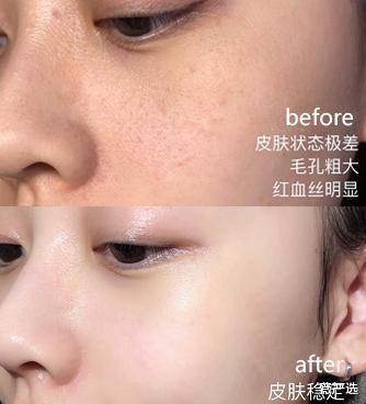 王鸥|王鸥不小心晒出的面膜, 却因价格太低被无视, 网友: 3次白的像牛奶!