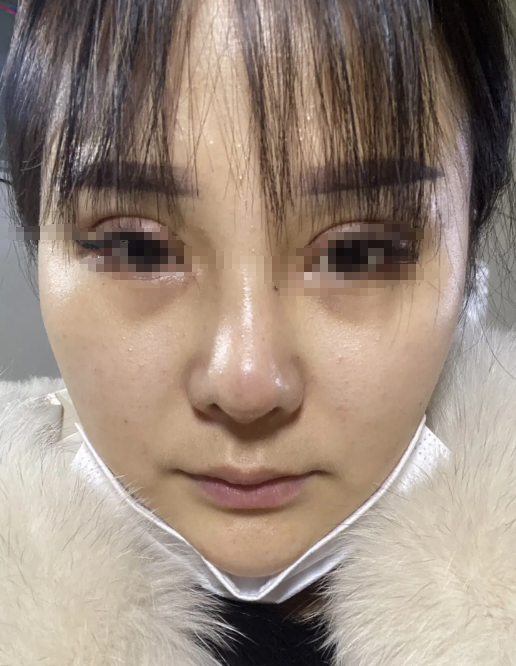 “不知道哪根筋搭错了，非要去整容”以前真好看