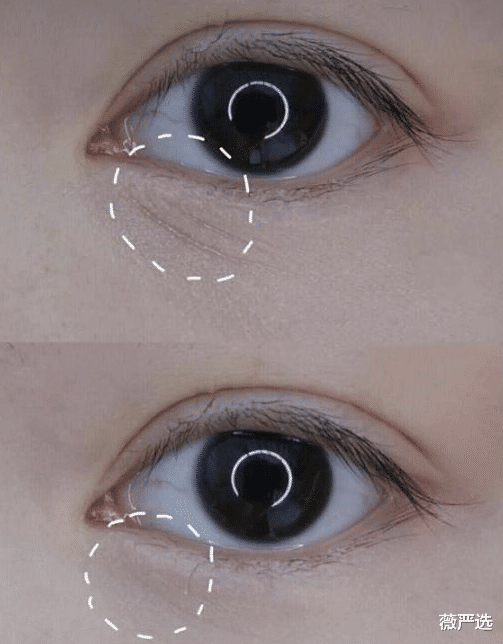 赵雅芝|67岁赵雅芝复出捞金,暴露真实状态!原来冻龄美图都是“照骗”?