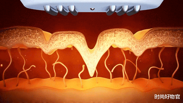 戚薇|一个被玻尿酸毁了的女星，如今38岁面目全非，年轻时五官精致耐看