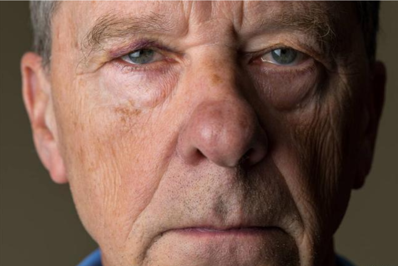 疾病|男性进入更年期的6大“丑态”，你占了几个？这项运动或能补救