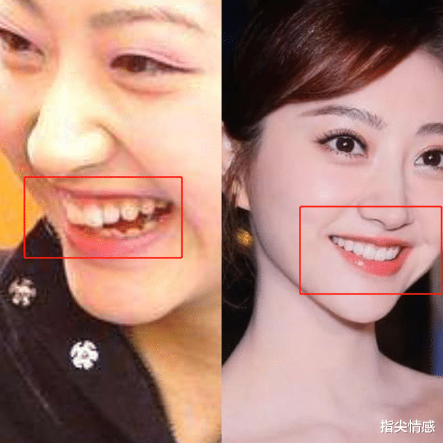 时尚好物官 李佳琦推荐的牙膏“火了”，景甜：黄牙消失了，网友：效果贼好