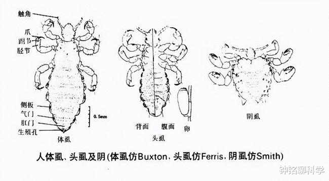 同样是虱子,为什么阴虱只能生活在阴部,无法在头发上生活?