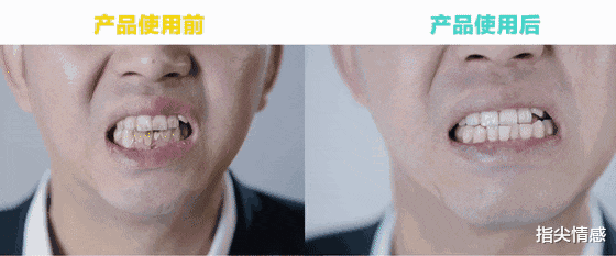时尚好物官 李佳琦推荐的牙膏“火了”，景甜：黄牙消失了，网友：效果贼好