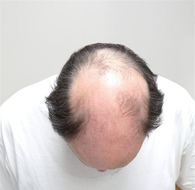 疾病|男性进入更年期的6大“丑态”，你占了几个？这项运动或能补救