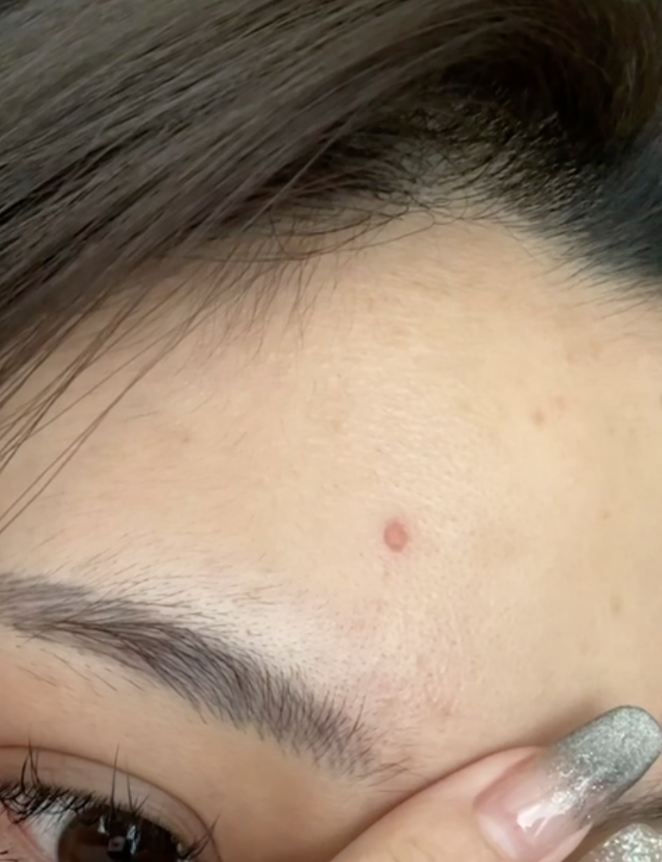 王思聪|王思聪女友:做饭被油烫伤,肌肤红润险些破相。拉开领口露胸前伤痕