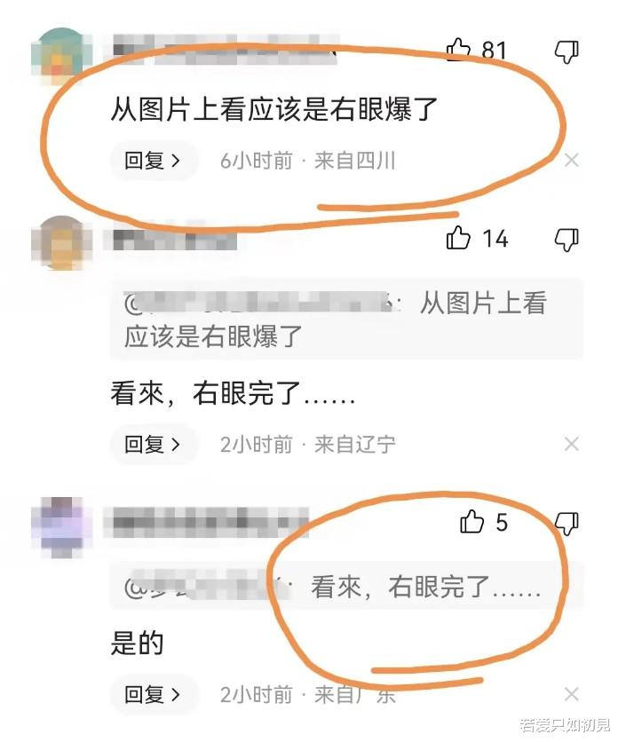 唐山事件中另一女生伤情鉴定出来了!右眼可能会失明,网友应多关注