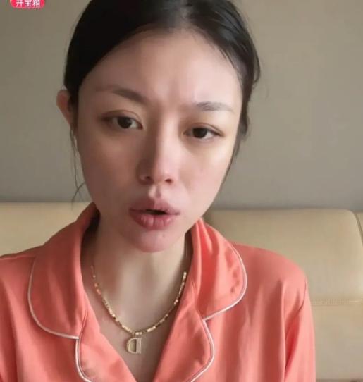 汪峰|汪峰前妻自曝欠60W外债，目光呆滞手臂抓痕明显，精神状态引担忧