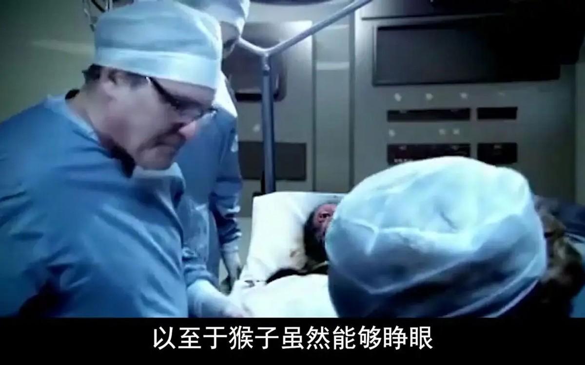 首例换头术,猴子换头后苏醒成功,一天后又被实施安乐死