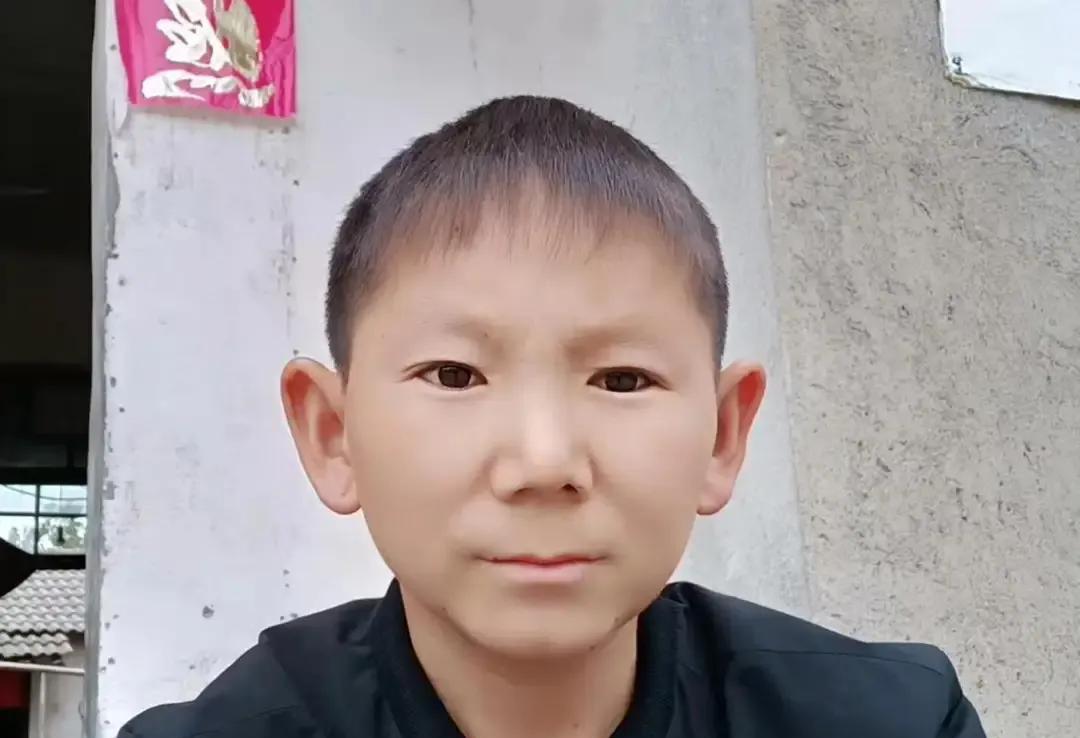 湖北小伙,年幼被石子砸中获“不老容颜”34岁无法娶妻:我还小