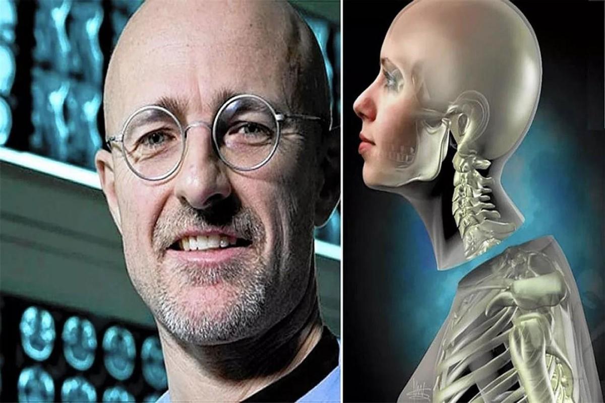首例换头术,猴子换头后苏醒成功,一天后又被实施安乐死