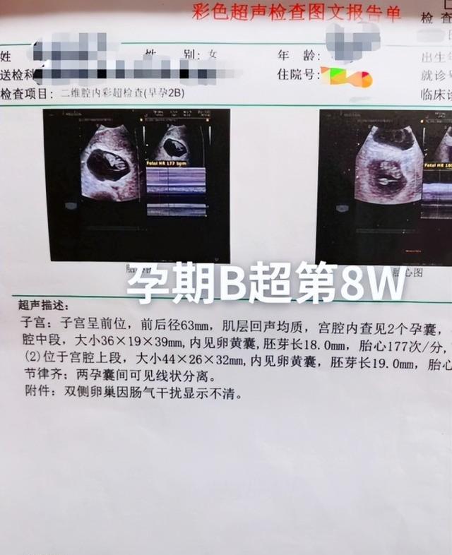 陈萌|陈萌晒孕8周产检单，直言对小伟的爱不是一时兴起，时间可以证明