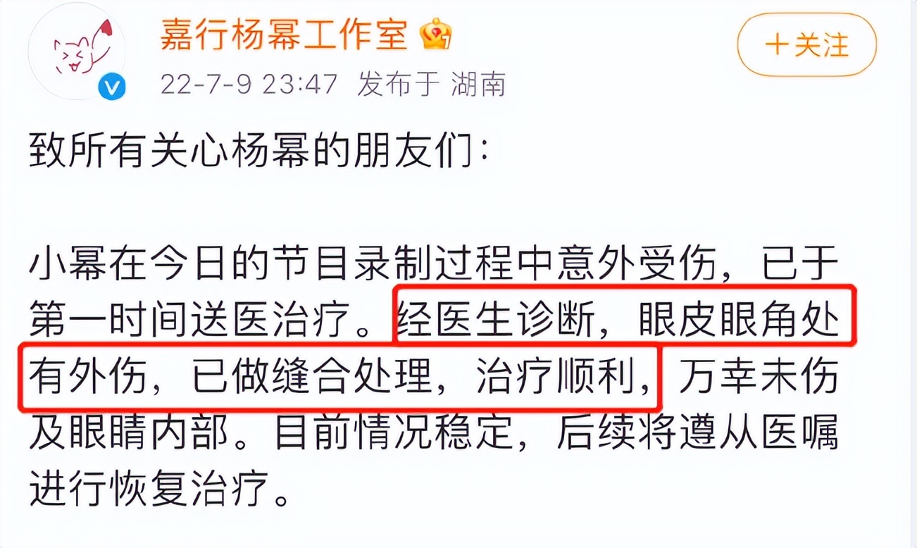 杨幂|杨幂眼部受伤后首次开工！一根腰带勒出细腰，脚踩拖鞋霸气十足