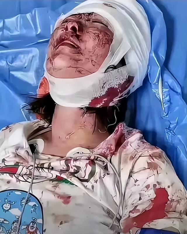 唐山打人案:四个被打女孩中,有两个情况不容乐观!
