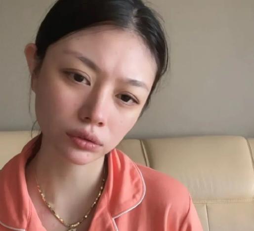 汪峰|汪峰前妻自曝欠60W外债，目光呆滞手臂抓痕明显，精神状态引担忧