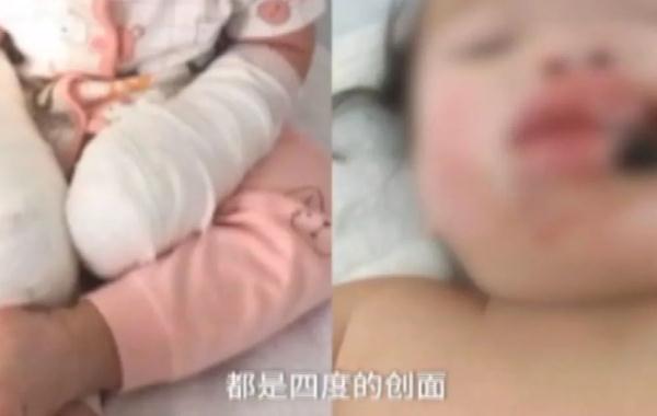 3岁女孩9根手指惨被切,醒来后痛哭:我想自己吃饭