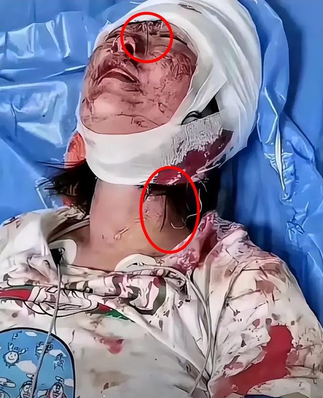 唐山打人案:四个被打女孩中,有两个情况不容乐观!