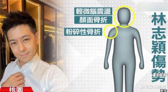 重症监护室|一波未平一波又起！林志颖仍在ICU治疗，如今又传来坏消息