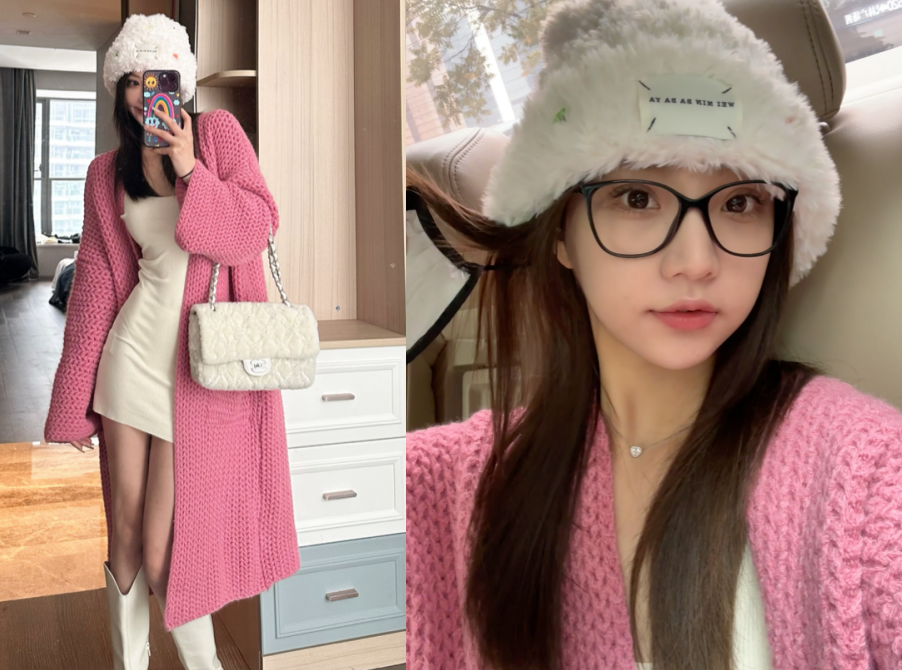 王思聪|王思聪女友:做饭被油烫伤,肌肤红润险些破相。拉开领口露胸前伤痕