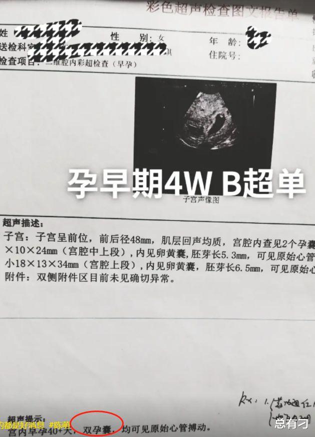 陈萌|?朱小伟妻子陈萌已怀4个月，而且是双胞胎，网友：亚男被打脸