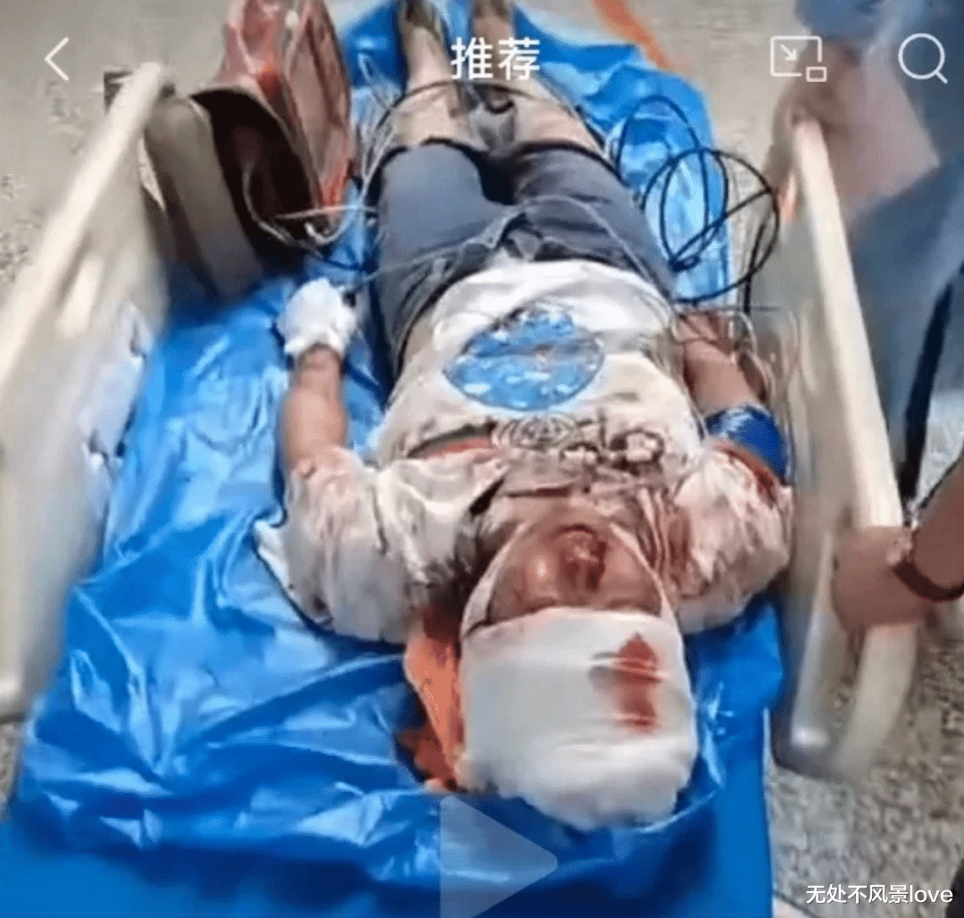 唐山事件中被打的女生,情况不止不太好……