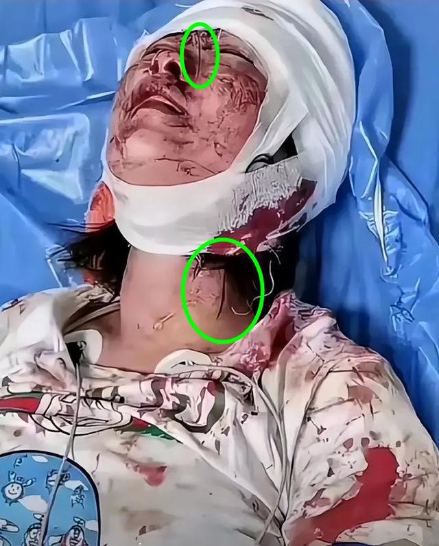 无法想象!唐山涉案黑衣女子与受伤女生住在同一家医院