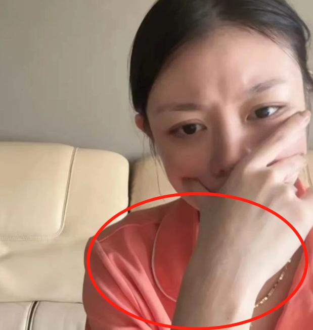 汪峰|汪峰前妻自曝欠60W外债，目光呆滞手臂抓痕明显，精神状态引担忧