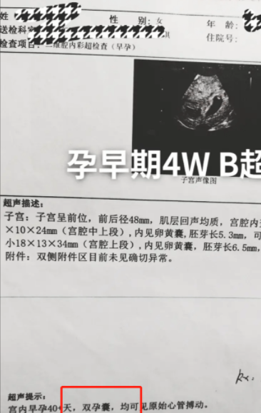 陈萌|?陈萌怀孕后到医院产检，大衣嫂全程陪同，我们都小看朱单伟了