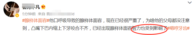 杜宇麒|《爸爸去哪儿》里的嗯哼，被指腺样体面容严重 连爸妈都曾认错 已影响智力