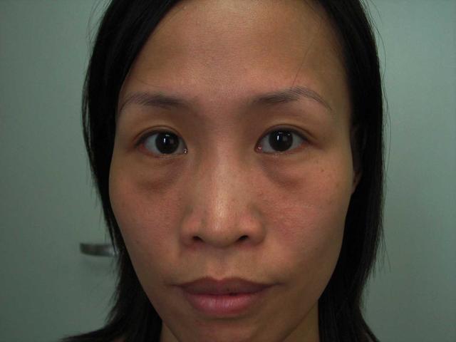 女人有眼袋不要慌, 每天定时吃点不贵的它, 眼袋淡了皮肤也好了