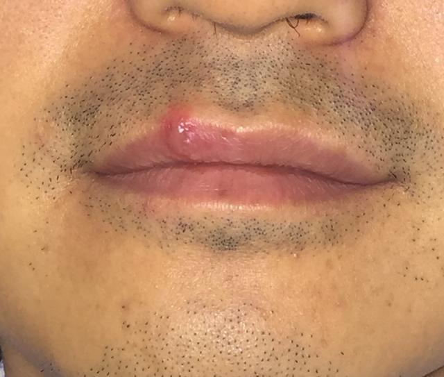 徐宏俊副主任医师-爱问医生