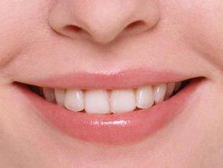 牙齿缝隙大的女人面相图片