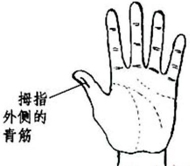 大拇指侧有青筋,代表头部供血不足,经常头痛,头晕.