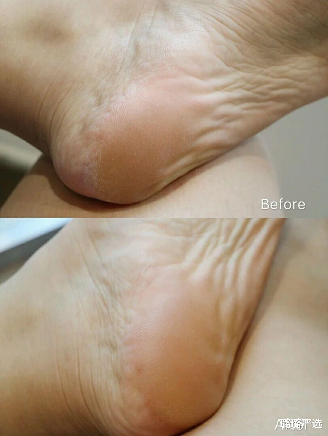 郑恺|郑恺发微博贴“足膜”,精致程度不输女明星,女人看了自愧不如