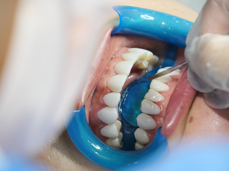 39健康网|牙齿出现松动,还能牢固吗?中医:一个方法掌握了,并不难