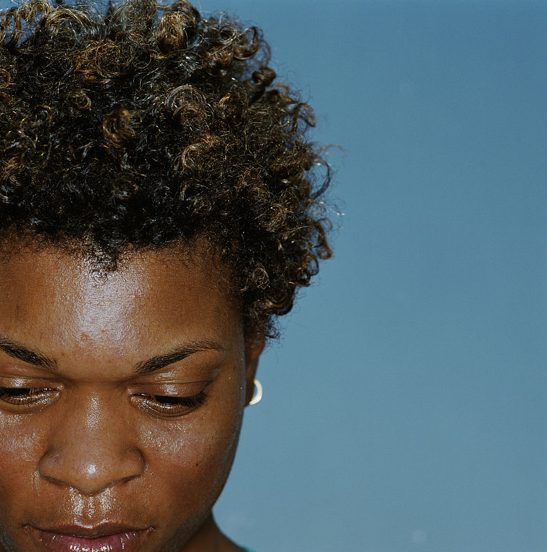 肝硬化|人的面部皮肤变黑，临床上涉及多种疾病，重要的有这4类