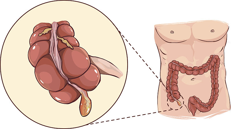 饮食|想要不得癌，这12点建议要听，让你远离“癌症”困扰！