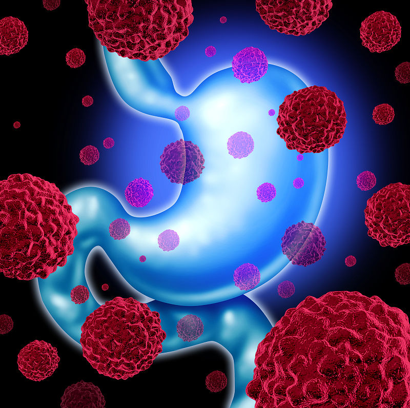 医生|如果发现自己有黑便的情况时切不可大意，医生：或是胃癌信号