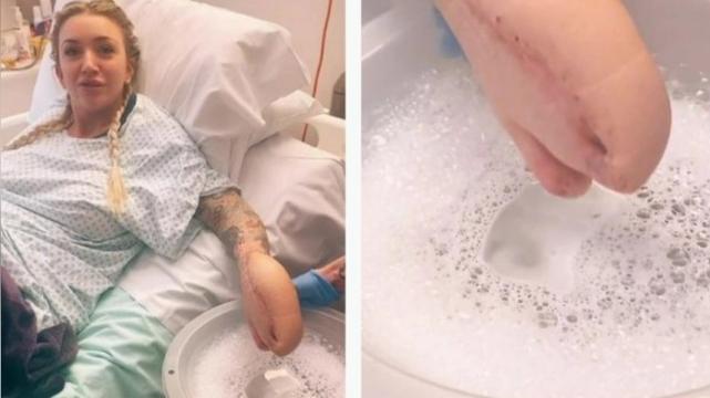 卡通|术后败血症不幸截肢，手变“卡通鲨鱼头”，她乐观配乐自嘲