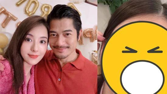 方媛|方媛手滑误传视频，鼻子歪斜疑似还有淡淡的疤痕，郭富城力挺爱妻